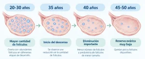 Infografía que muestra la disminución de la reserva ovárica y los folículos en los ovarios según las etapas de edad: de 20 a 30 años, 35 años, 40 años y de 45 a 50 años