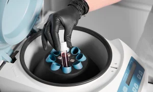 Muestra de laboratorio colocada en una centrífuga para su procesamiento durante un procedimiento médico o de reproducción asistida.